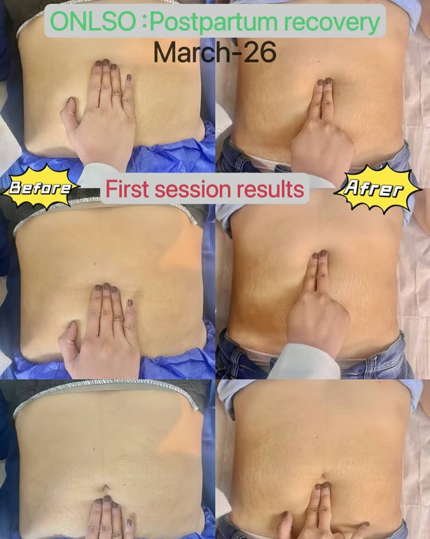Top 10 Postpartum Recovery Centers in the Philippines 2026 (Research & Field Test Edition A Must-Read for Expectant Mothers)